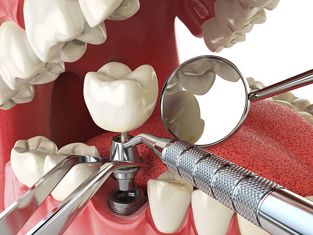 Best Emergency Broken Tooth Repair in Batesville, MS